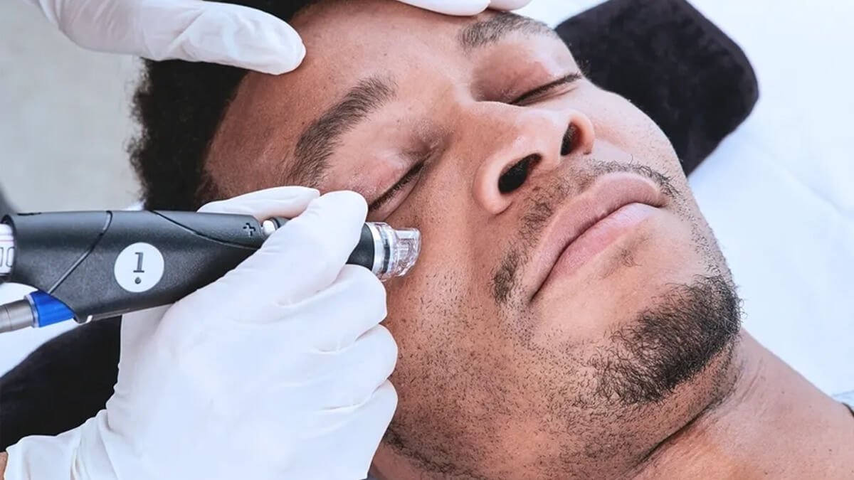 Hydrafacial